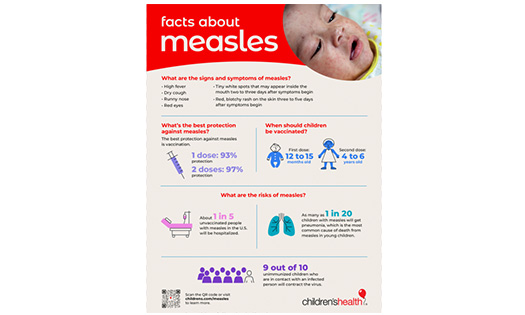 English Measles Infographic